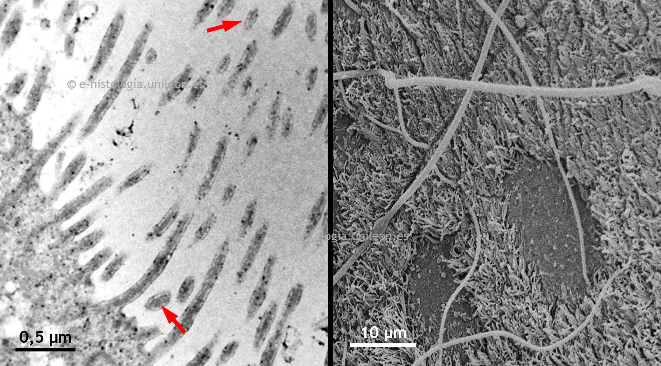 Estereocilios del polo apical del epitelio epididimario. Microscopía electrónica de transmisión (MET) y de barrido (MEB)