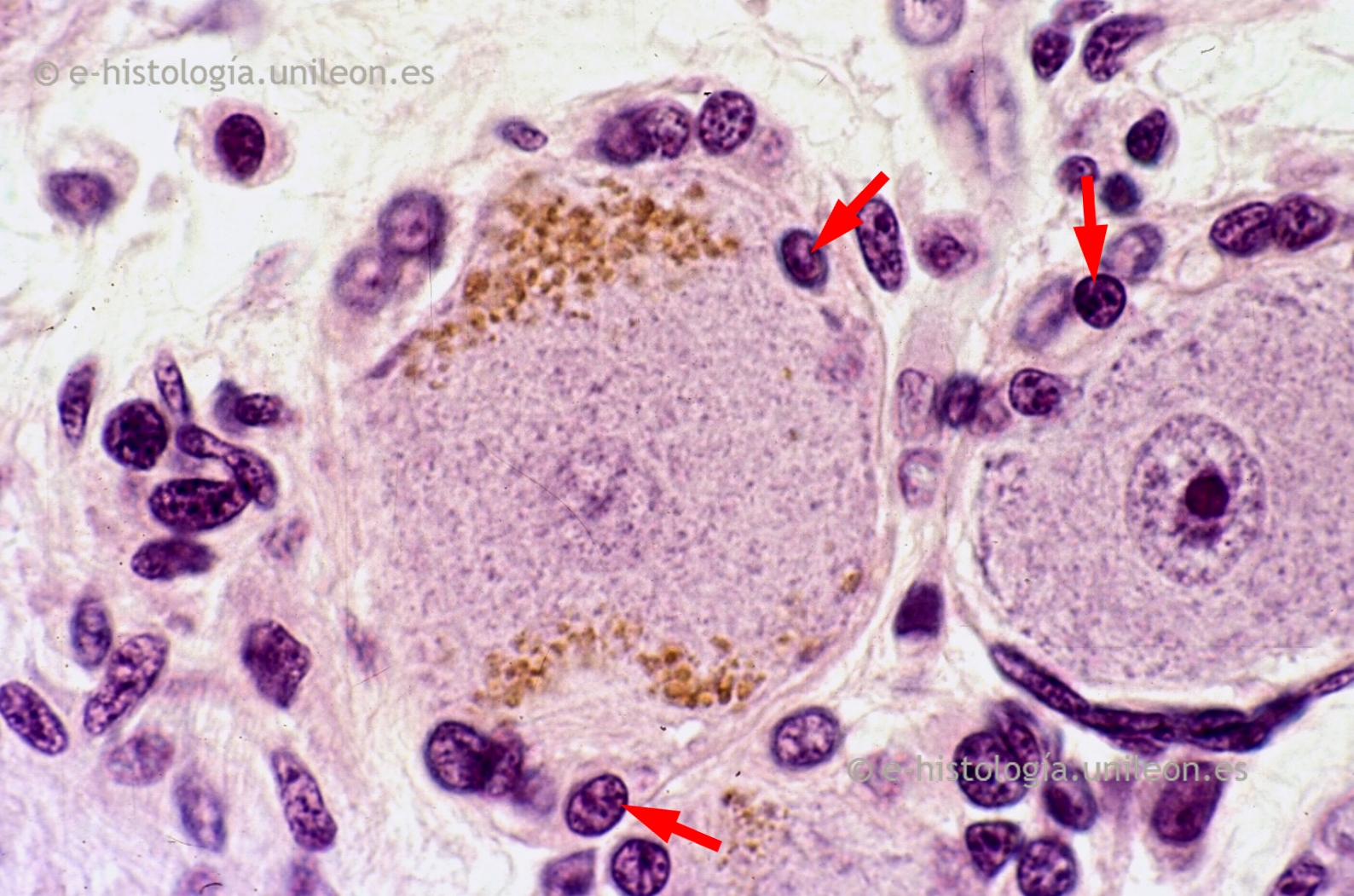 Inclusiones: lipofucsina en neuronas ganglionares x1.000