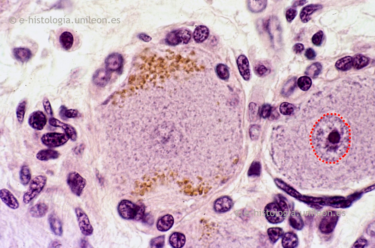 Inclusiones: lipofucsina en neuronas ganglionares x1.000