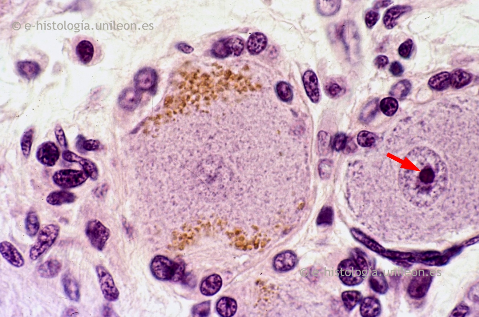 Inclusiones: lipofucsina en neuronas ganglionares x1.000