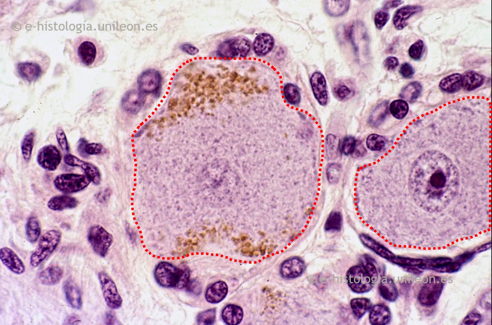 Inclusiones: lipofucsina en neuronas ganglionares x1.000