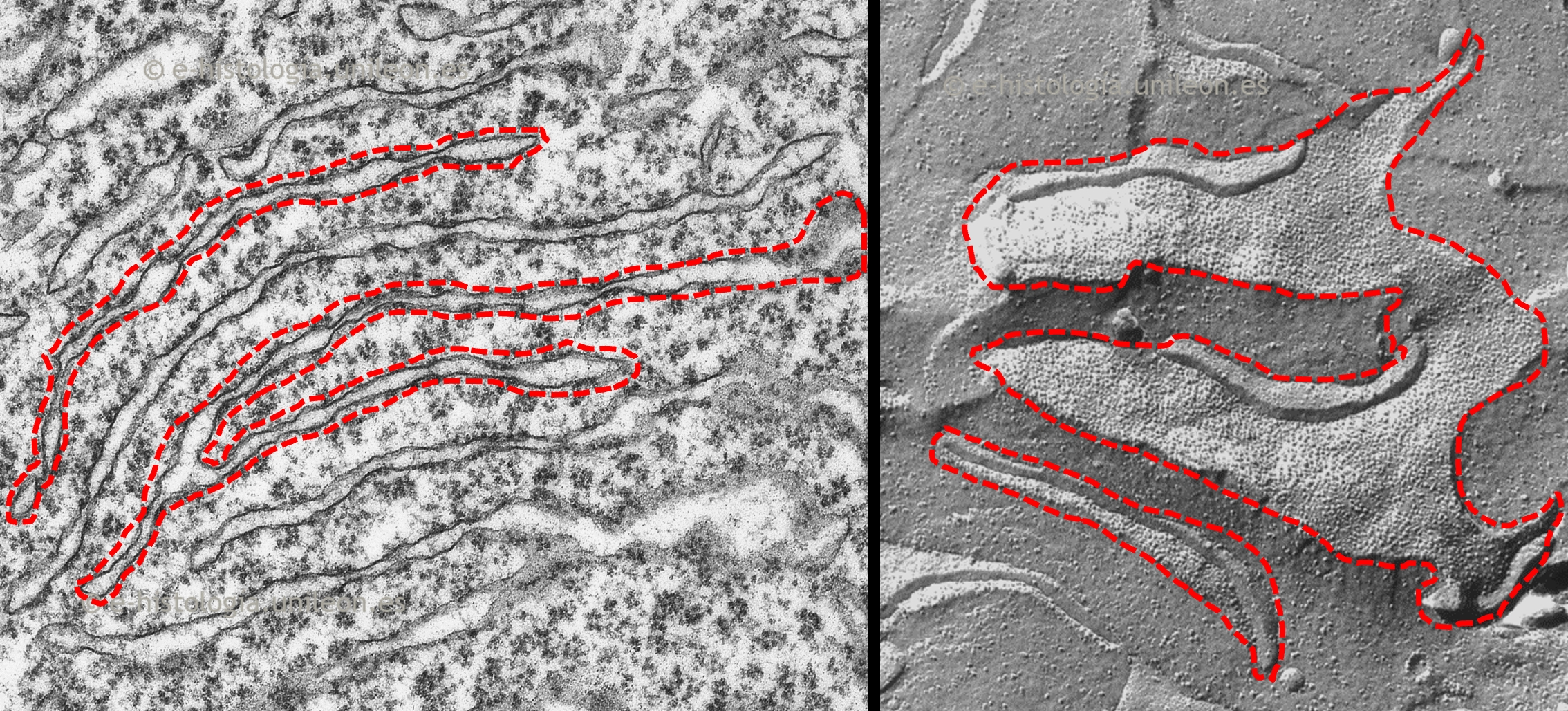 Sistema de endomembranas: cisternas del retículo endoplasmático rugoso (RER). MET y criofractura.