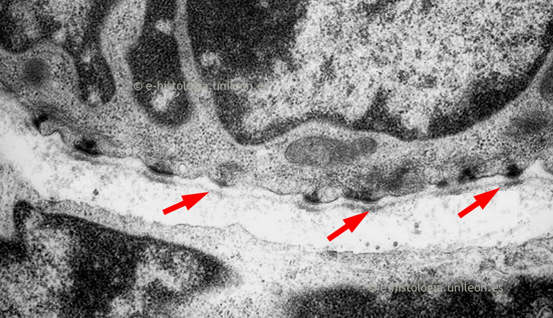 Uniones intercelulares: hemidesmosomas. MET.